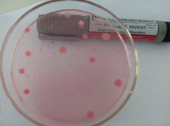 ATP熒光檢測器識別細菌的優缺點